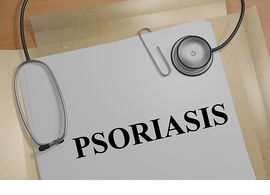 Psoriasis Treatment